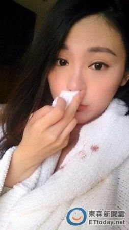 臺美女主播在京不適應天氣流鼻血粉絲心疼獻計