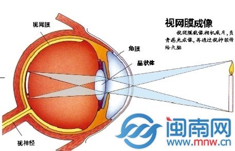 27歲網店店主每天上網超10小時 右眼突然失明