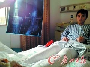 男子疑遭其妹前男友報復 腳筋腿筋全被砍斷