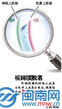 27歲網店店主每天上網超10小時 右眼突然失明