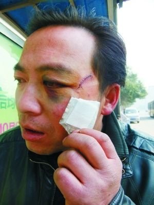 受傷村民。本報記者 張學江 王釗 攝