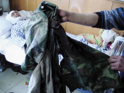 男子進山采藥遭遇大黑熊 大腿被啃咬露出骨頭