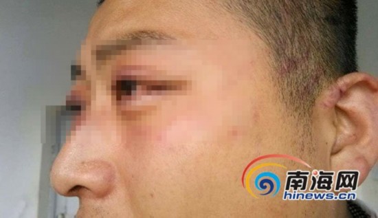 三亞一大學生稱晚歸遭保安毆打 學校稱沒這事